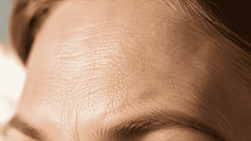 Close-up macro of mature forehead skin texture showing fine lines and early wrinkles — the biological difference between fine lines and deeper wrinkles